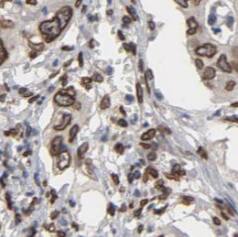 Spectrin beta 2 Antibody - BSA Free