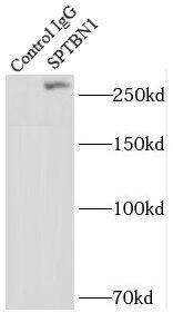 Spectrin beta 2 Antibody - BSA Free