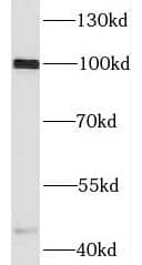 Signal Peptide Peptidase Antibody - BSA Free