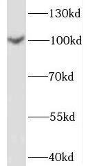 SPOCD1 Antibody - BSA Free