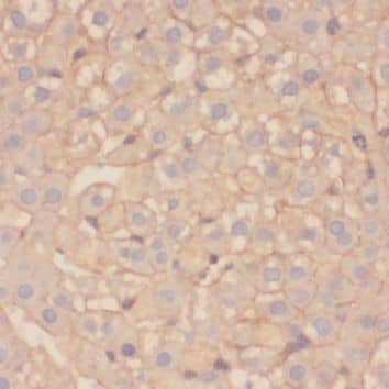 SPINK9 Antibody - BSA Free