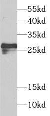 SPIN2B Antibody - BSA Free
