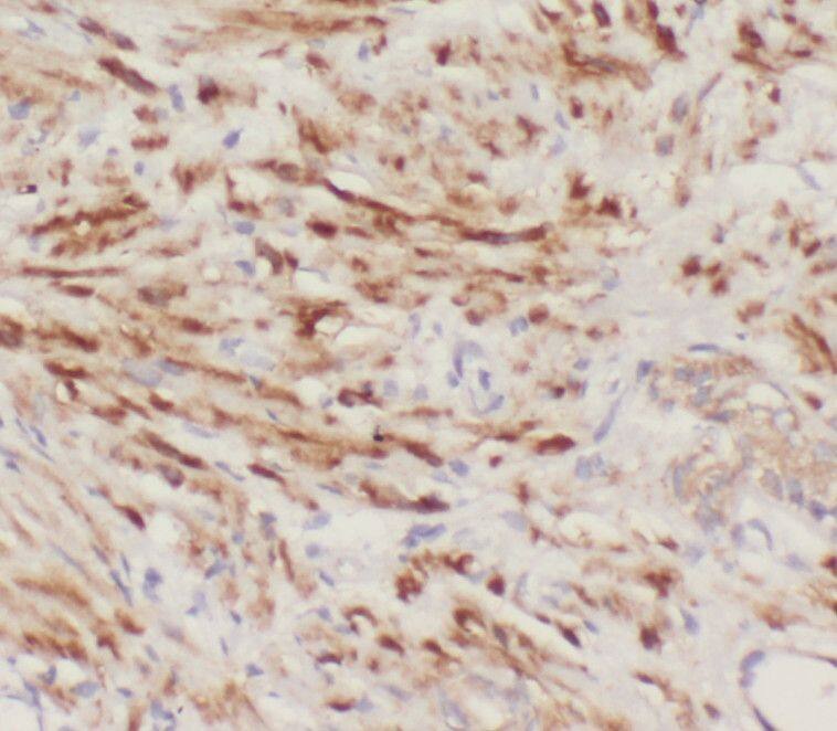 SPCS1 Antibody - BSA Free