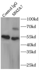 SPATA7 Antibody - BSA Free