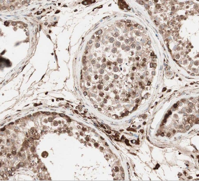 SPATA6 Antibody - BSA Free