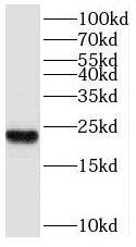 SPANXB1 Antibody - BSA Free
