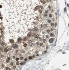 SPANXA1 Antibody - BSA Free