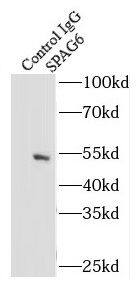 SPAG6 Antibody - BSA Free