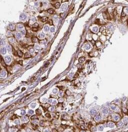 SPAG4 Antibody - BSA Free