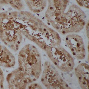 SPACA1 Antibody - BSA Free