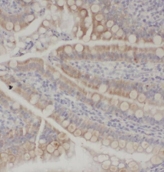 SOAT 2 Antibody - BSA Free
