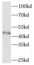 SOAT 2 Antibody - BSA Free
