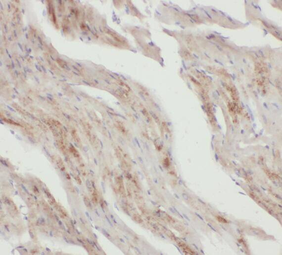 Snx6 Antibody - BSA Free