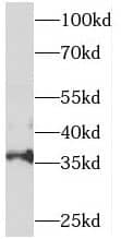 SNX20 Antibody - BSA Free