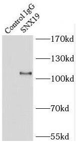 SNX19 Antibody - BSA Free