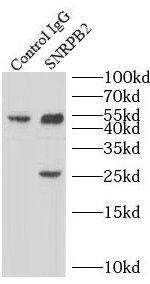 SNRPB2 Antibody - BSA Free