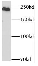 ASCC3L1 Antibody - BSA Free