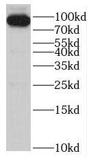 SMYD4 Antibody - BSA Free