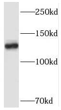 SMC5 Antibody - BSA Free