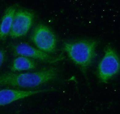 SLN Antibody - BSA Free