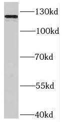 SLITRK3 Antibody - BSA Free
