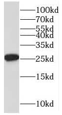 GINS4 Antibody - BSA Free