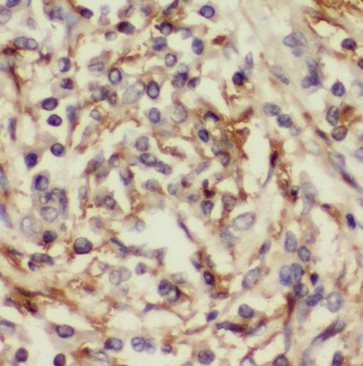 SLCO6A1 Antibody - BSA Free