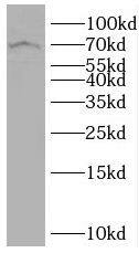 SLC7A4 Antibody - BSA Free