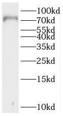 SLC5A3 Antibody - BSA Free