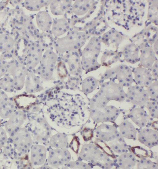 SLC38A4 Antibody - BSA Free