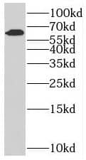 SLC38A4 Antibody - BSA Free