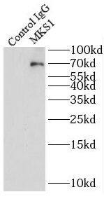MKS1 Antibody - BSA Free