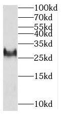 MITD1 Antibody - BSA Free