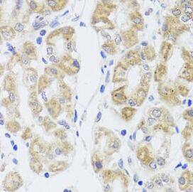 Aquaporin-0 Antibody - BSA Free