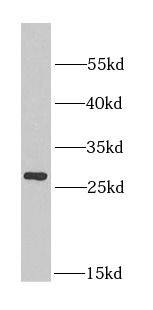 Aquaporin-0 Antibody - BSA Free
