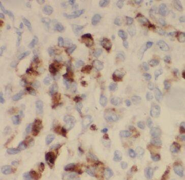 MICAL2 Antibody - BSA Free
