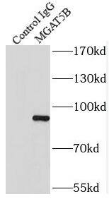 MGAT5B Antibody - BSA Free