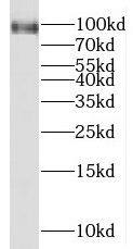 MGAT5B Antibody - BSA Free