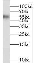 MGAT4C Antibody - BSA Free