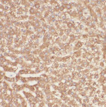 MGAT2 Antibody - BSA Free