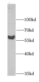 MGAT1 Antibody - BSA Free
