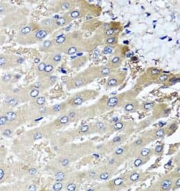 MGAT1 Antibody - BSA Free