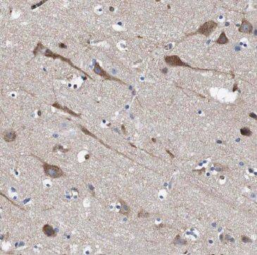 MFSD8 Antibody - BSA Free