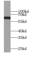 MFSD2 Antibody - BSA Free
