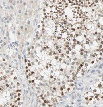 Methyltransferase like 6 Antibody - BSA Free