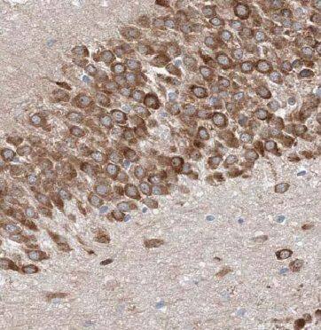 Methyltransferase like 5 Antibody - BSA Free