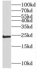 Methyltransferase like 5 Antibody - BSA Free