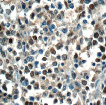 MEF2BNB Antibody - BSA Free