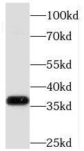 MECR Antibody - BSA Free