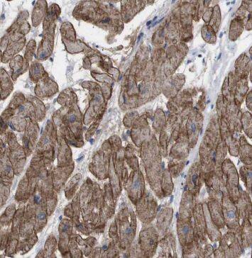 MECR Antibody - BSA Free